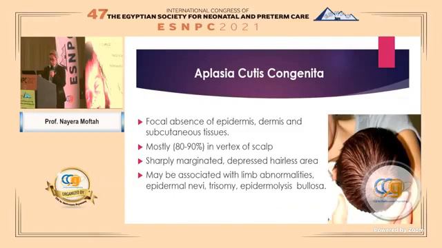 Common Neonatal Skin Disorders: What Should We Know ?
By Prof. Nayera Moftah смотреть онлайн