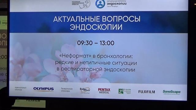 Бронхо 30 10 Гасанов АМ Диссекция бронхогенной кисты трахеи с помощью бронхоскопа