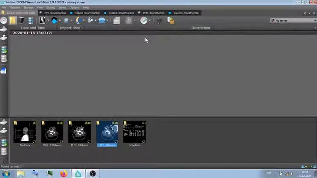 КТ АНГЕО ГОЛОВА ШЕЯ . смотреть онлайн