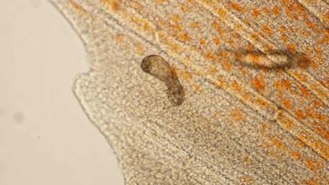 Gyrodactylus adults (skin fluke) infestation on fins of goldfish (x100) смотреть онлайн