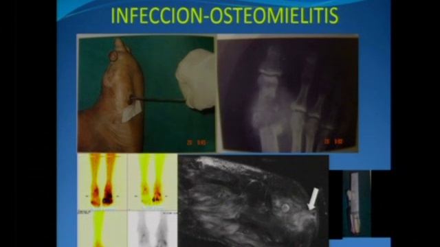 XV Congreso De Endocrinología del Perú Part 37 смотреть онлайн