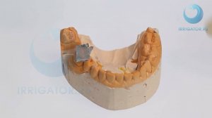 Парасепт - паста для временного пломбирования