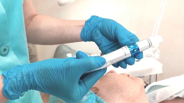 Фракционная мезотерапия аппаратом Medi+Derma Nanopore Pen (Испания)