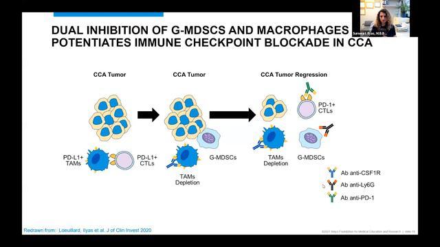 ICRN Webinar: Targeting Immunosuppressive Myeloid Cells in Cholangiocarcinoma смотреть онлайн