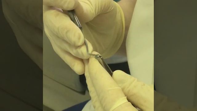 Не откладывайте преображение Вашей улыбки на завтра смотреть онлайн
