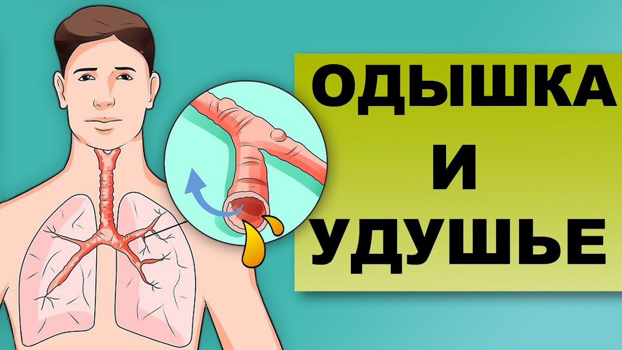 ОДЫШКА И УДУШЬЕ смотреть онлайн