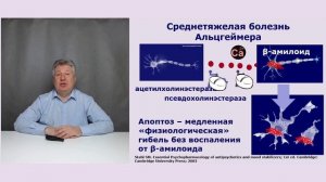 Лечение болезни Альцгеймера.