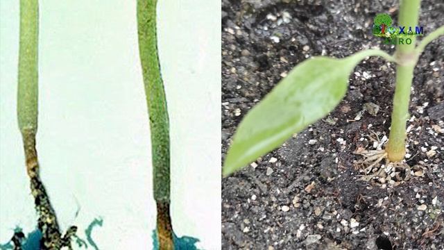 QORA SON KASALLIGI HAQIDA GAPLASHAMIZ