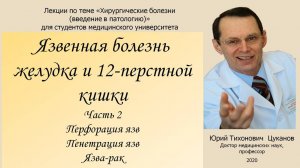 Язва желудка и 12-ти перстной кишки, часть 2. Лекция для студентов медуниверситета.