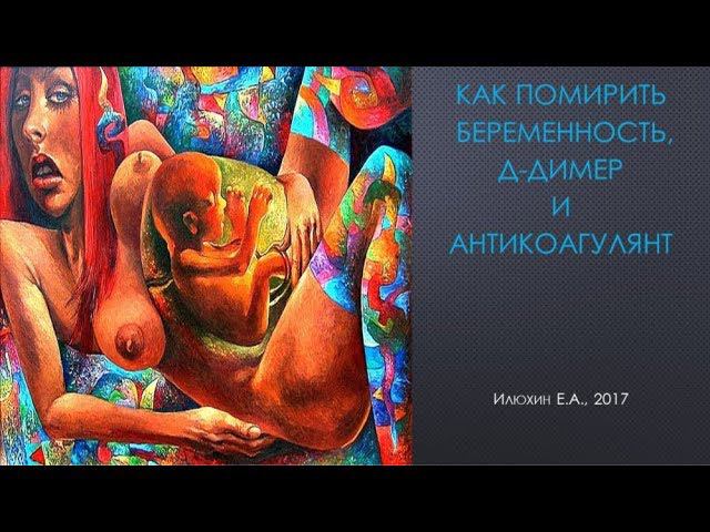Как помирить беременность и Д-димер смотреть онлайн