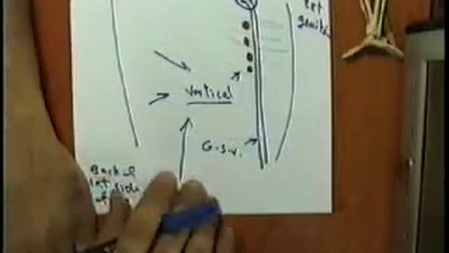 INGUINAL LYMPH NODES :DR SAMEH GHAZY смотреть онлайн
