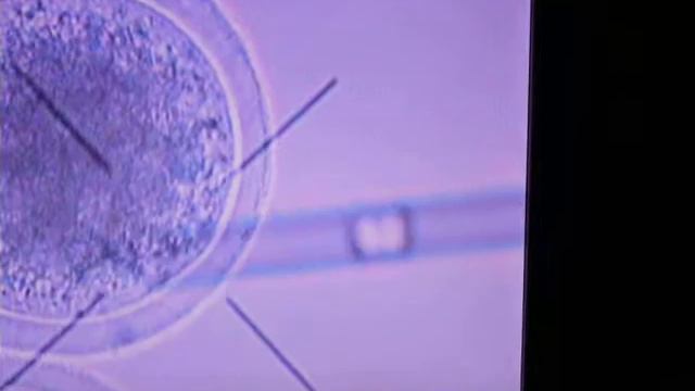 Somatic cell nuclear transfer (Cloning): 2nd step Cell injection смотреть онлайн