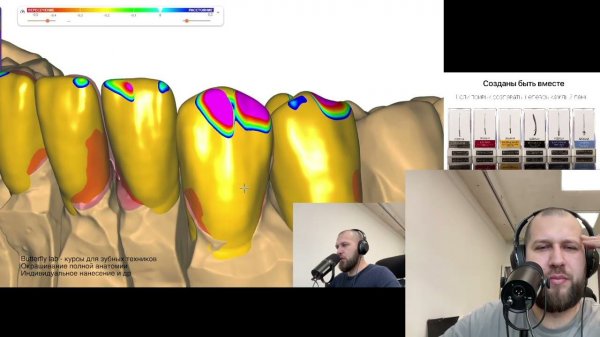 Exocad 3.1 rijeka modelling. dental cad. exocad video. exocad Video Tutorial