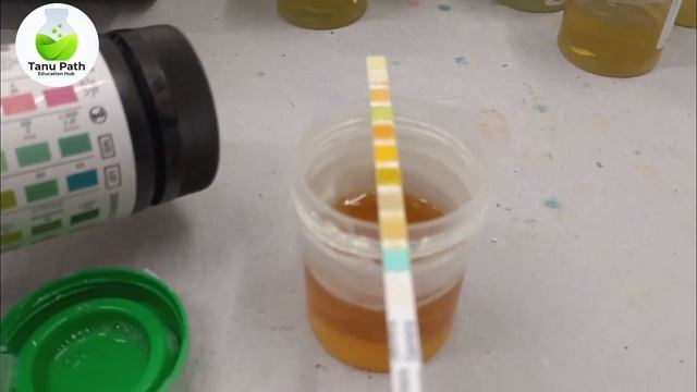 urine routine test | Urine Routine Manual Test смотреть онлайн