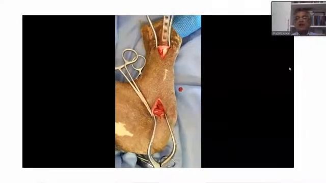 ''Minimal İnvaziv Plak Osteosentezi (MIPO) Tekniği