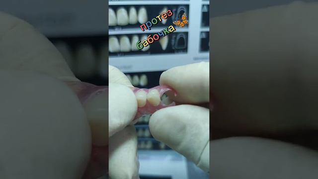 протез бабочка🦋 смотреть онлайн