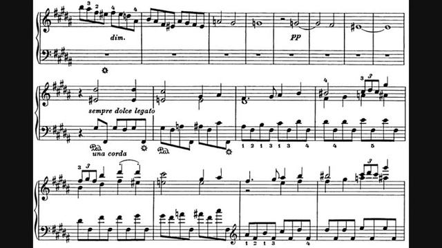 Liszt - En rêve: Nocturne, S. 207 (1885) [André Laplante] смотреть онлайн