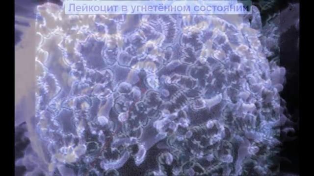 ПОБЕДИ РАК НЕ ТЕРЯЯ НИ МИНУТЫ смотреть онлайн