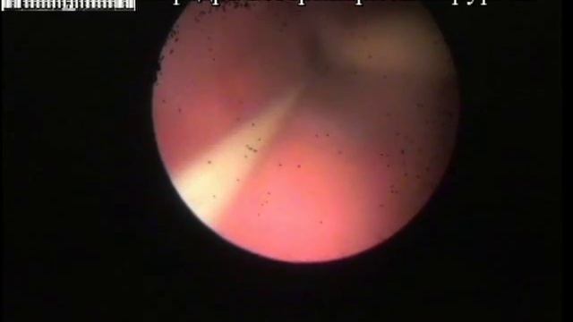 Дилятация стриктуры пищевода у кошки смотреть онлайн