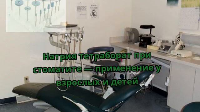 Натрия тетраборат при стоматите — применение у взрослых и детей смотреть онлайн