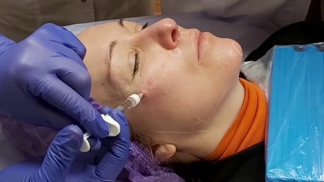 АирисКом студенты учатся: практика учеников, филлеры для заполнения области скул. смотреть онлайн