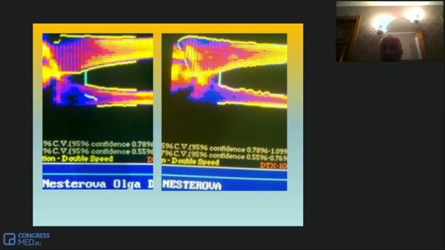 Каким должно быть лечение переломов. Доклад д.м.н., профессора В. И. Струкова
