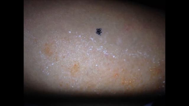 Morgellons and Slime Mold Shape Shifting Simulating смотреть онлайн