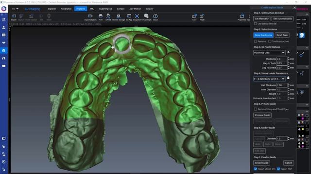 Romexis How To: Designing implant guides смотреть онлайн