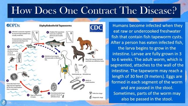 Diphyllobothriasis - The Fish Tapeworm Infection смотреть онлайн