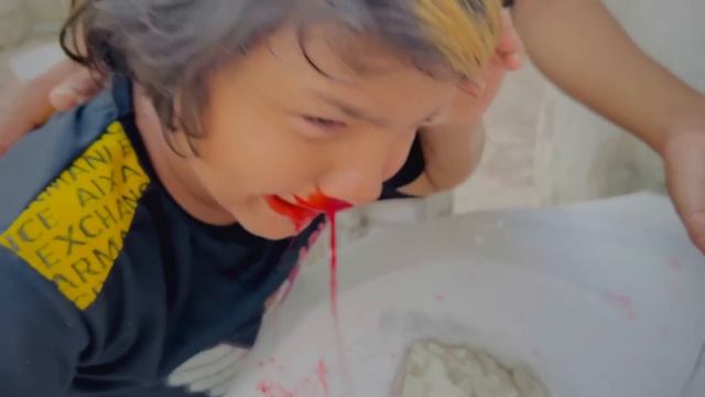 Ali ki nakseer chot gai 😳 || bht khon aya 🥺 смотреть онлайн