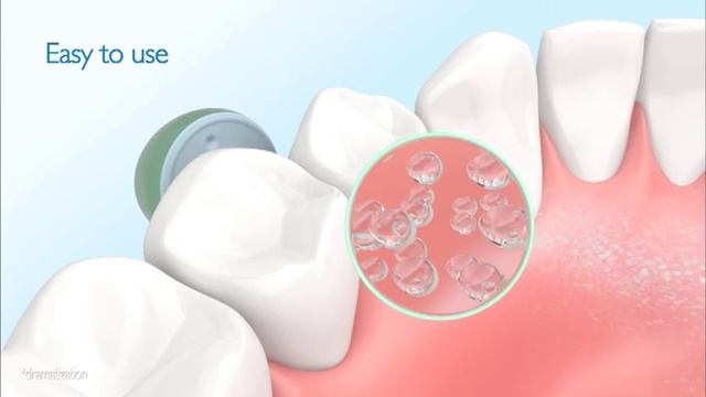 Förebygg blödningar & inflammation i tandköttet med Philips AirFloss смотреть онлайн