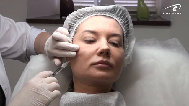 Коррекция верхней трети канюлей смотреть онлайн