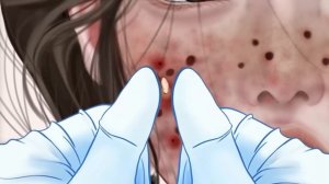 ASMR Remove Maggot & Worm Infected Belly | Deep Cleaning Animation