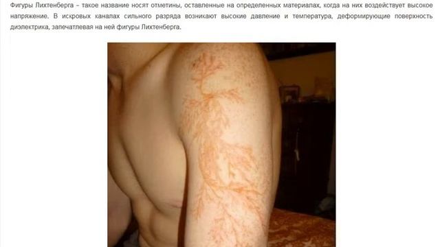 Шрам после удара молнии смотреть онлайн