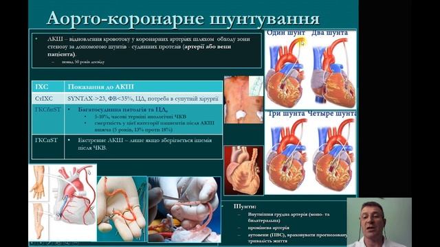 Лекция для студентов 5 курса мед.факультета. Актуальные вопросы кардиохирургии. проф. В.Д. Шейко смотреть онлайн