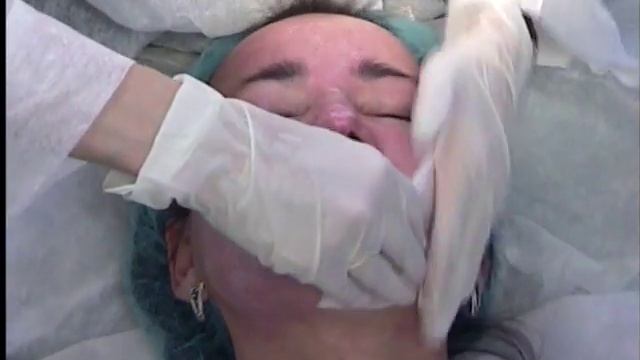 Enerpeel TCA 25% Joanna смотреть онлайн