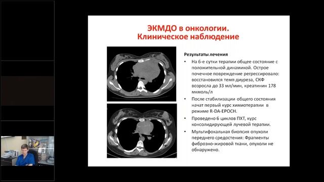 Опыт внедрения экстракорпоральных методов детоксикации в МРНЦ. Потапов Александр Леонидович смотреть онлайн