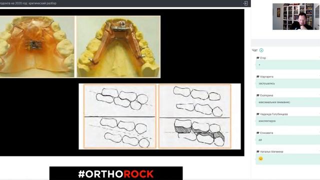 Третий вебинар: Критическая оценка ортодонтических знаний на 2020 год смотреть онлайн