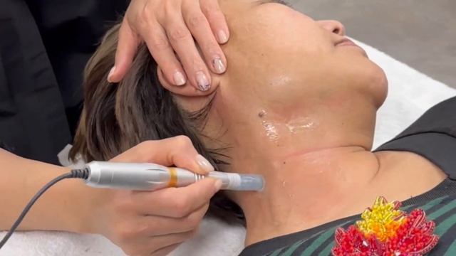 Как избавиться от пигментации, веснушек и морщин? Аппарат DermaPro смотреть онлайн