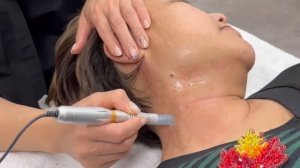Как избавиться от пигментации, веснушек и морщин? Аппарат DermaPro