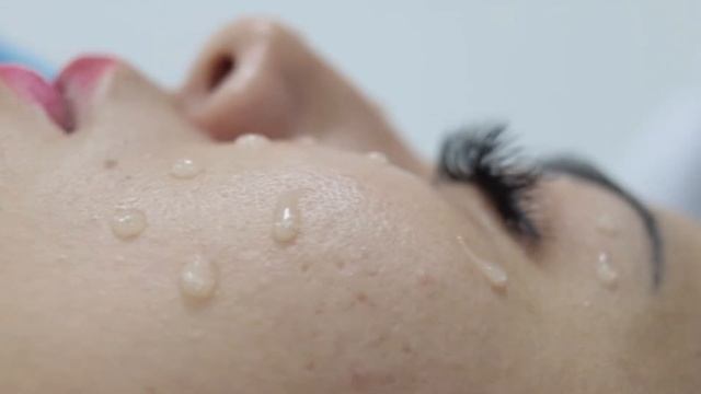 О процедуре 