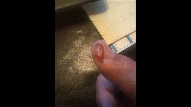 mandolin slicer accident смотреть онлайн