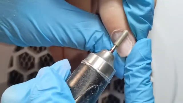 Маникюр на проблемной кутикуле*смена формы*укрепление углов. смотреть онлайн