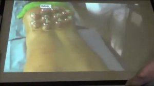 Хазов О. Э. Баночный массаж