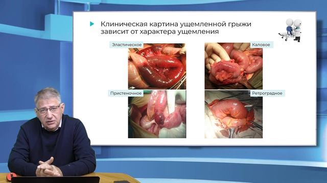 15:30 08.10.22 Закрытые травмы живота с повреждением паренхиматозных органов. Часть 2 смотреть онлайн