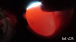 Как выглядит кровяное кольцо на яйце курицы.