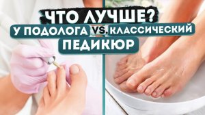 ПЕДИКЮР У ПОДОЛОГА. Чем отличается от эстетического? Мнение подолога| MEDPED
