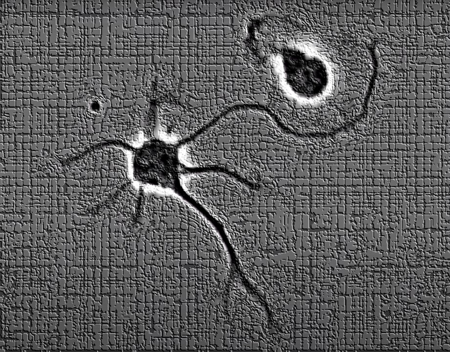 Нормальный нейрон и мутировавший нейрон под микроскопом