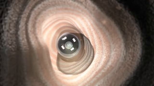 обучающий промо ролик PillCam COLON на русском смотреть онлайн