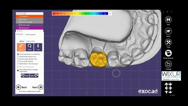 Exocad - Hotkeys Video Tutorial